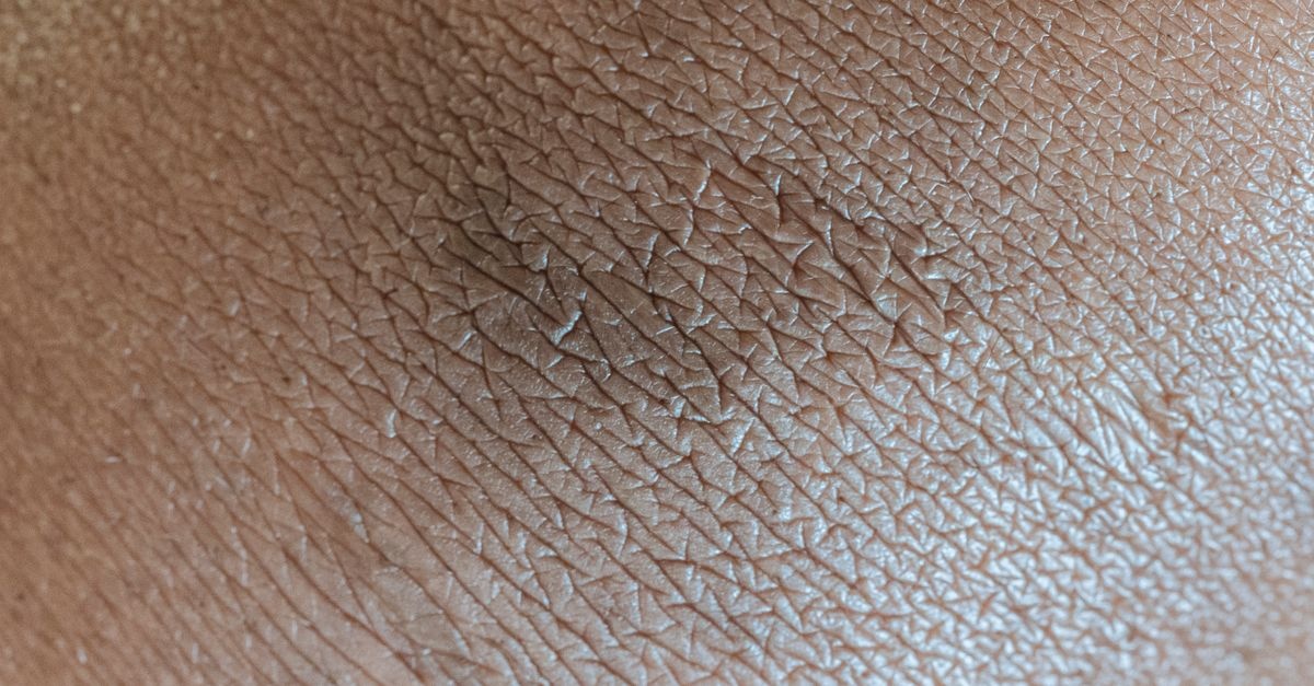 Aine irritée : comprendre les causes et apaiser la peau rapidement