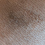 Aine irritée : comprendre les causes et apaiser la peau rapidement
